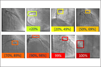 Más de 6.000 imágenes para apoyar el diagnóstico de enfermedades cardiovasculares